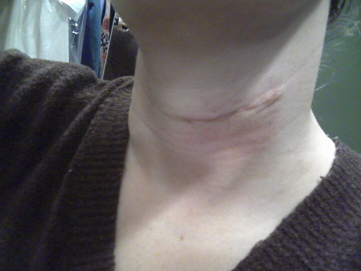 neck surgical