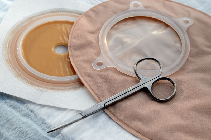 Ostomy bag or pouch