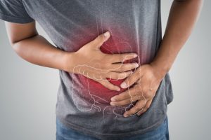 How To Prevent Colon Polyps