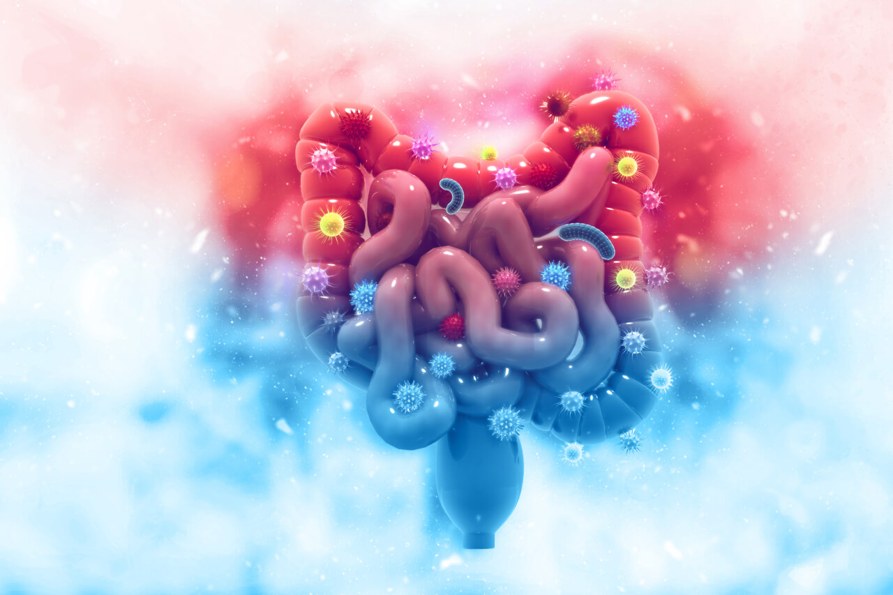 Colon Cancer Surgery