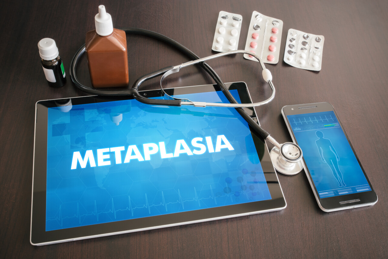 Intestinal Metaplasia