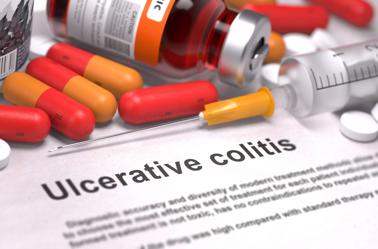 Medication For Ulcerative Colitis