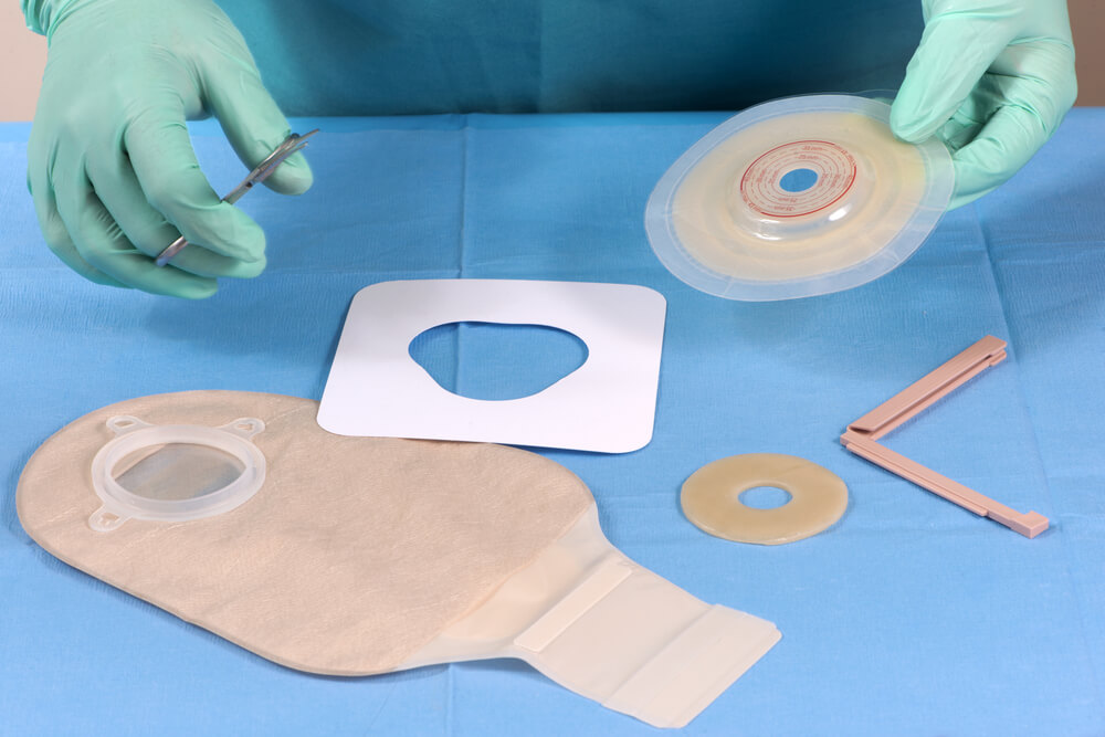 A Rule of Thumb On How Often To Change Ostomy Bag