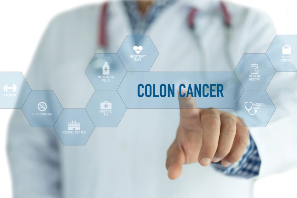 Ask your doctor about your colon cancer treatment cost.