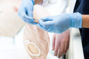how to clean an ostomy bag