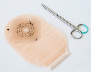 elderly patients ostomy related complications