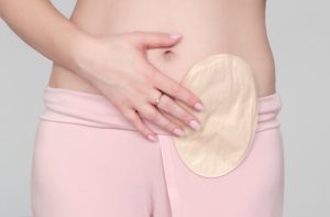 stoma bag stoma bags
