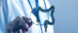 acute perforated diverticulitis