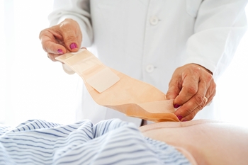 What Happens to Your Anus After a Colostomy? A Comprehensive Guide